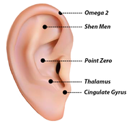 Battlefield Acupuncture (BFA) Ear Points