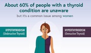 Graphic of hypothyroidism and hyperthyroidism