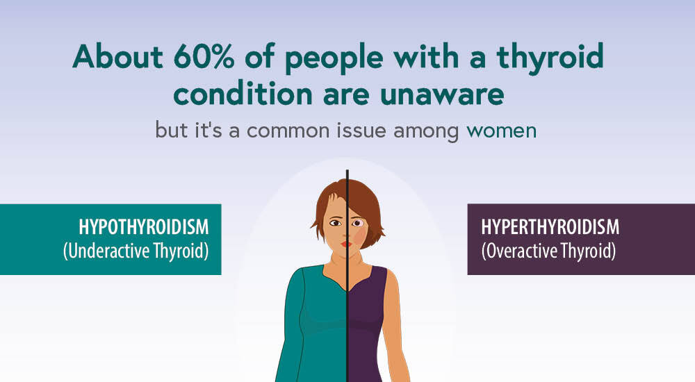 About 60% of people with a thyroid condition are are unaware.