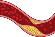 Cholesterol graphic