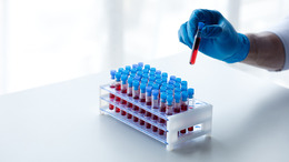 Blood samples in a test tube rack.