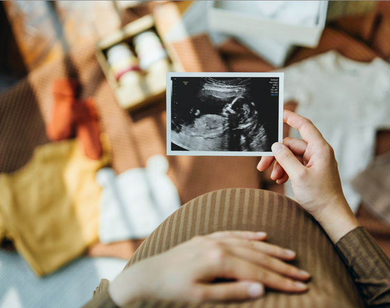 Doula 