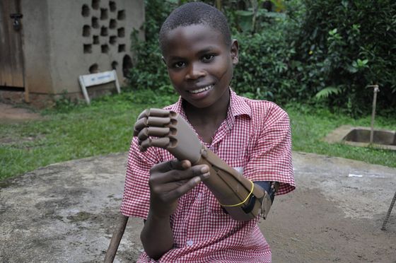 Child with 3D Printed Hand