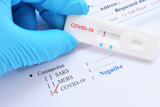 Cvoid-19 Rapid Antigen Test