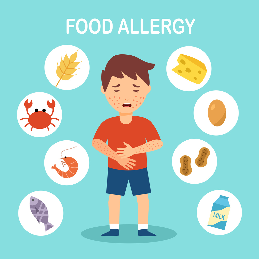 Food Allergies 