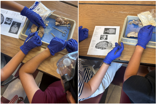 dissection