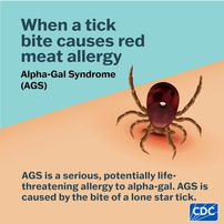 Alpha Gal Syndrome. When a tick bite causes red meat allergy.