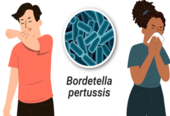 pertussis