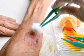 Image of arm wound being cleaned