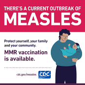 Current measles outbreak graphic