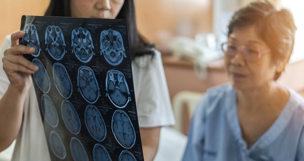 A doctor explaining an MRI to an elderly patient