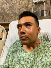 Injured worker in hospital bed