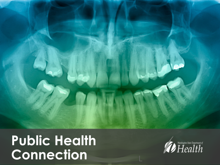 An X-ray of a patient?s jaw appears to be smiling.