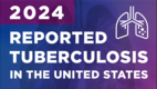 2024 CDC Reported TB in the US