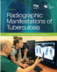 Radiographic Guide