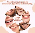 Dental Screening Image