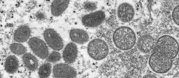 Picture of Monkeypox virus cells