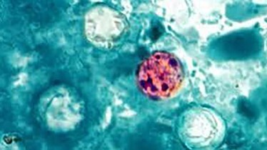 Cyclosporiasis Parasite 