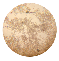 cyanobacteria micro