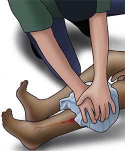 graphic of a person applying pressure to a bleeding wound on a leg