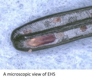 a microscopic view of EHS