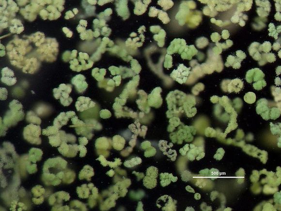 Colonies of Microcystis, a common genus of freshwater cyanobacteria
