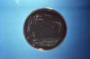 Blue and black Petri dish with Legionella culture 