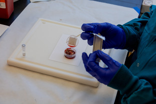 CWD sample testing